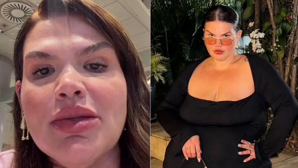 Thais Carla revela planos para retirar excesso de pele após perder 120 kg